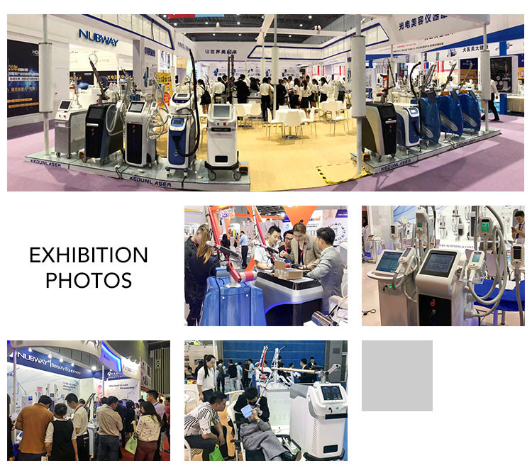 2018 Latest technology tattoo removal q switched nd yag laser medical ce
