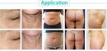 BeautySalon Equipment weight loss machine fat burning instrument vacuum