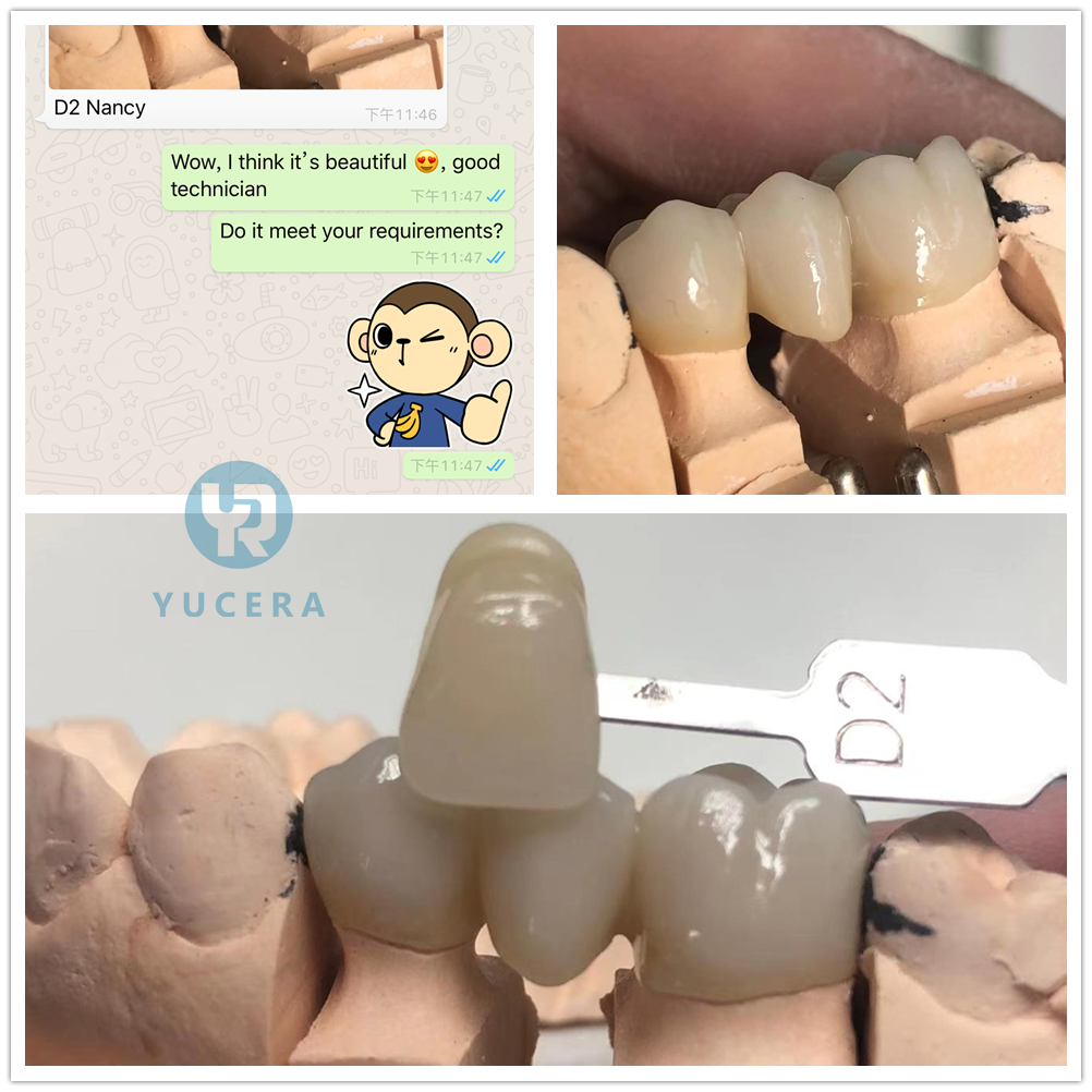 900Mpa SHT Multilayer Zirconia Disc For Dental Implants Dental Consumables
