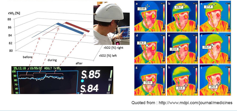 Low Level Transcranial Helmet 810nm Near Infrared Biomodulation