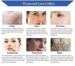 220V Picosecond Laser Tattoo Removal Machine For Cleaning Skin Rejuvenation