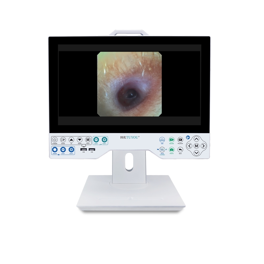Good Quality 1080P 15.6 Inch Medical Endoscopy Equipment Rigid & Flexible Laryngoscope Imaging System