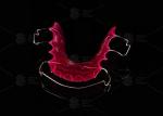 Comfortable Stainless Steel Acrylic Hawley Retainer Effective Orthodontic