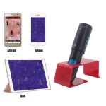 Wireless Digital Dermatoscope Skin Microscope for Professional Diagnosis