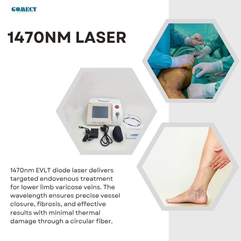 Minimally Invasive 1470nm Diode Laser Vein Removal Machine for EVLT Treatment Solutions