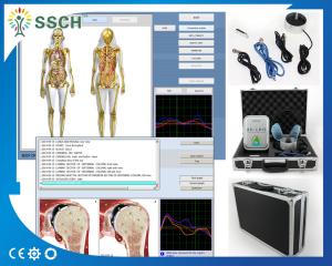 Wholesale Bioresonance Therapy Health Analyzer Machine , Quantum Bio feedback from china suppliers