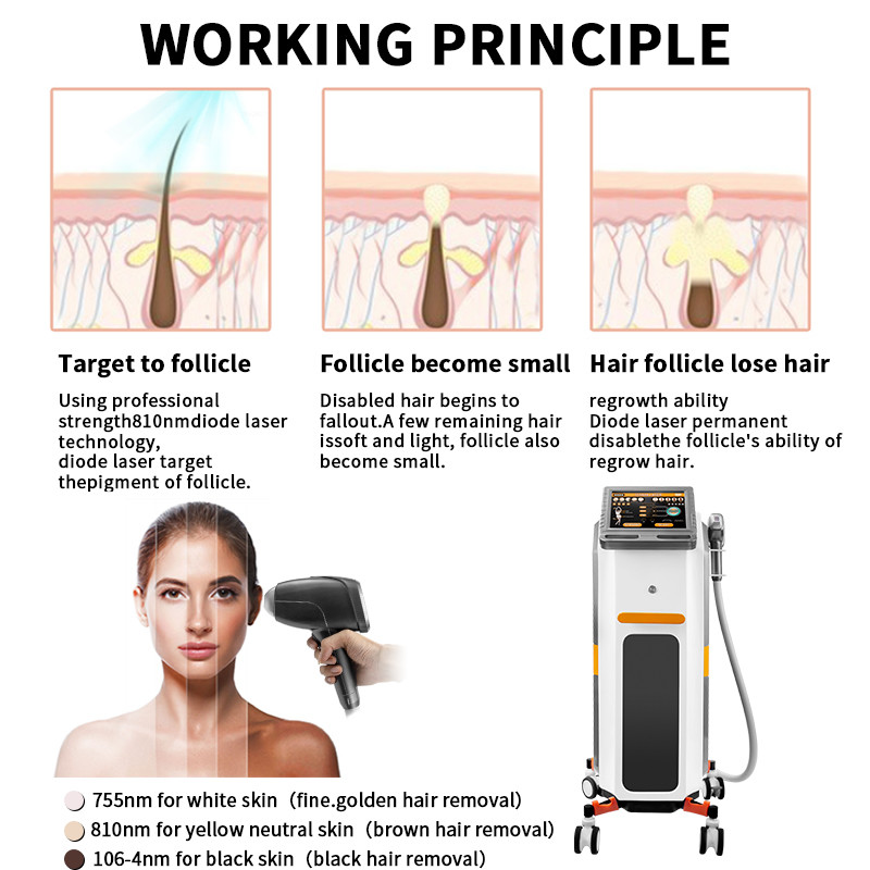 Fast Diode Laser Hair Removal Machine Triple Wave 810nm Skin Rejuvenation 2000w
