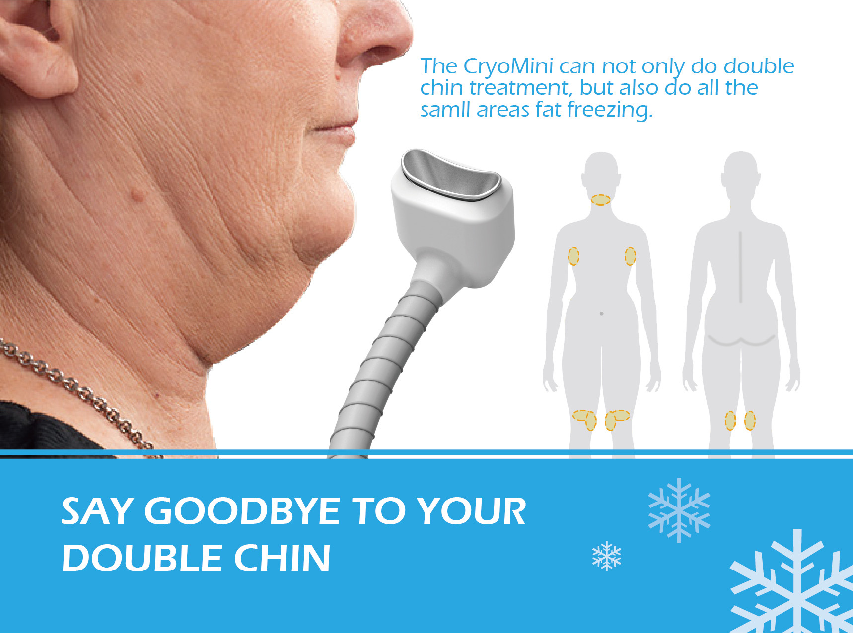 Cryotherapy Slimming Machine With Different Handles Cryo fat reduction device Fit