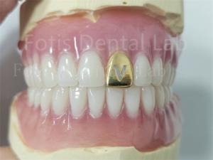 Wholesale Comfortable Precision Fit Full Acrylic Denture Prosthesis With Natural Teeth from china suppliers