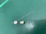 Mindary VS600 Vital Signs Patient Monitor Parts Keypad Screw Fixed Silicone