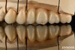 Natural Looking Multilayer Full Zirconia For Dental Restorations Ultra