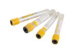 Medical Grade Vacuum Blood Test Tube for Safe and Blood Collection