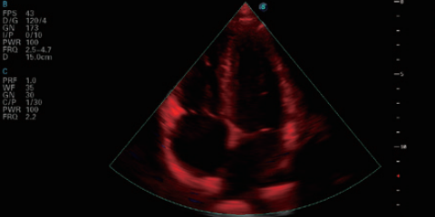 New design cardiac and 4d function Sonoscape P15 ultrasound for hospital