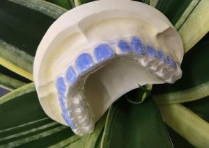 Wholesale ISO13485 Teeth Whitening Bleach Guard For Smoke Stains from china suppliers
