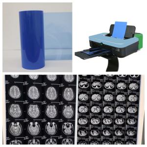 Wholesale 17inch Inkjet X Ray Film For Medical Imaging 8x10 10x12 11x14 14x17 A4 A3 A3+ 13X17 from china suppliers