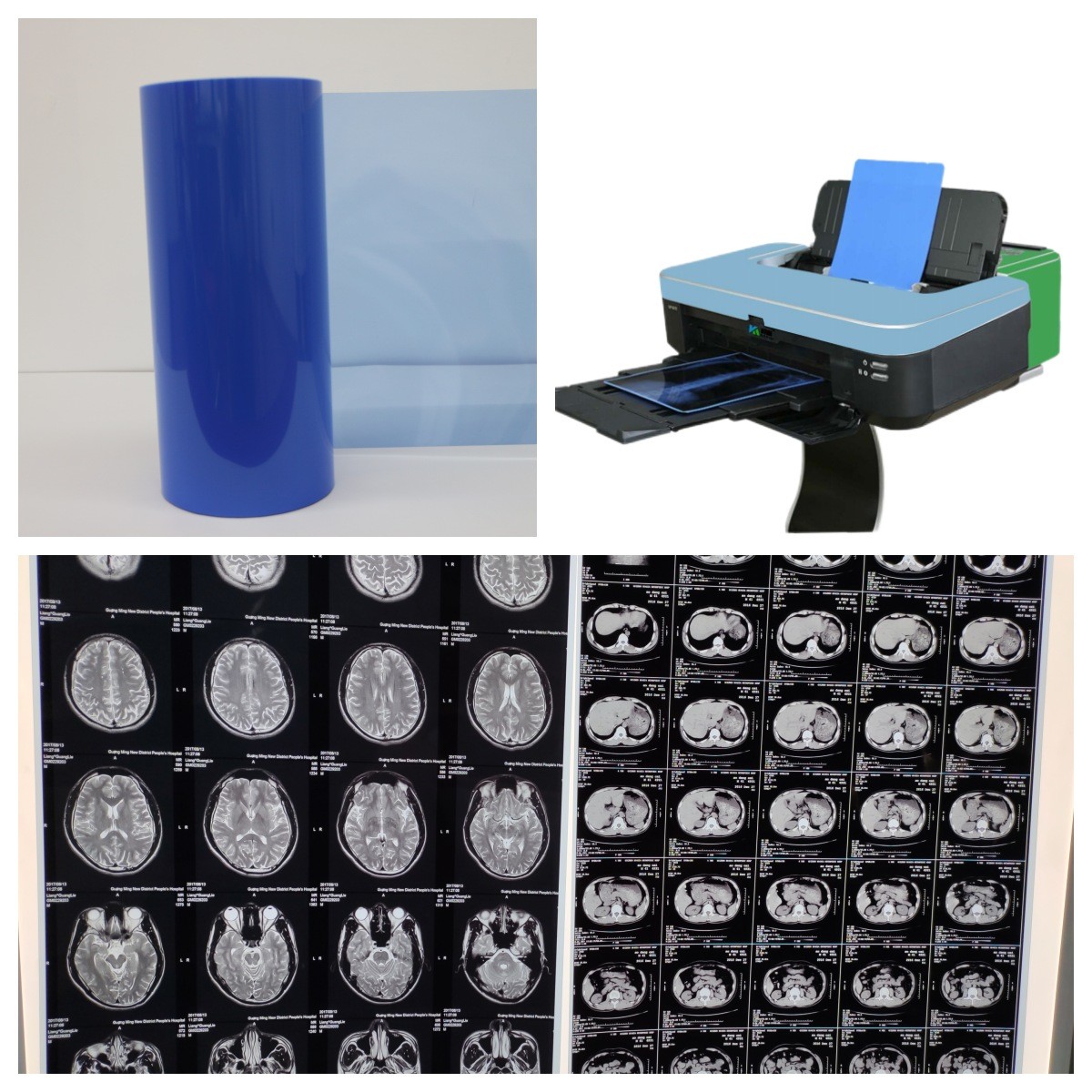 PET Film Base Blue Transparent Color Medical X ray films for X-ray Diagnosis