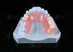 TCS Flexible Partial Stain Resistant BPA Free Partial Dentures For Natural Look