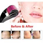 high quality derma roller Best Skin Roller 540 Titanium Micro Needles 0.5mm/1mm