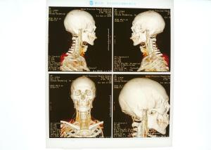 Wholesale 13in * 17in Low Fog Medical Xray Paper film For Konida Laser Printer from china suppliers