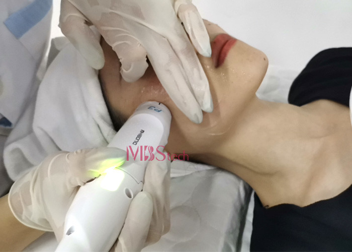 High Intensity Focused Ultrasound 9D HIFU Machine Wrinkle Removal