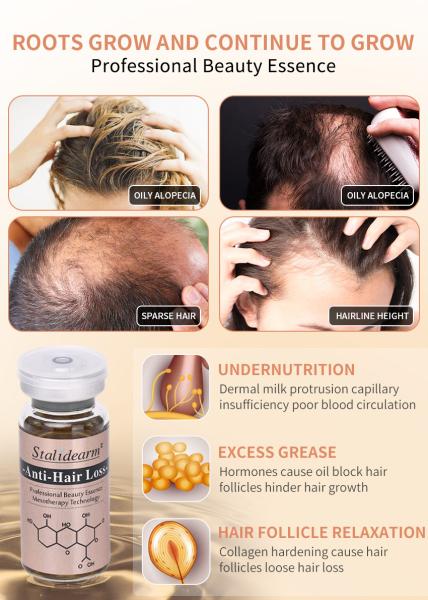 Anti Hair Loss Serum Set No Needle Mesotherapy Formula For Hair Regrowth 10ml