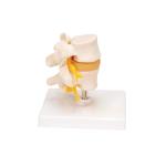 0.45kg Medical Anatomy Education 20x16x10cm Lumbar Spine Model