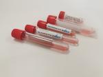 DNA Oral Sterile VTM Disposable Virus Sampling Kits