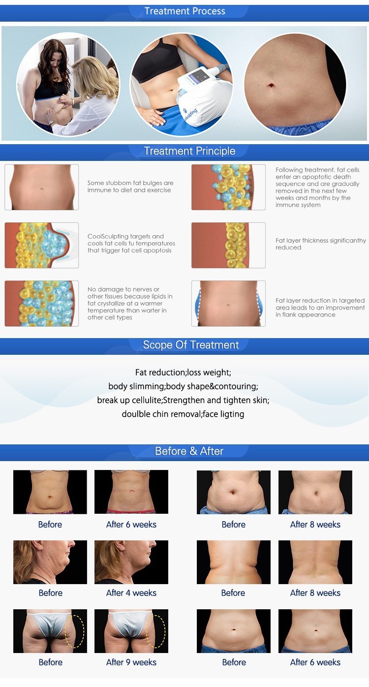 Wholesale beauty supply distributors NUBWAY vacuum cavitation / fat freezing slimming machine for cooling