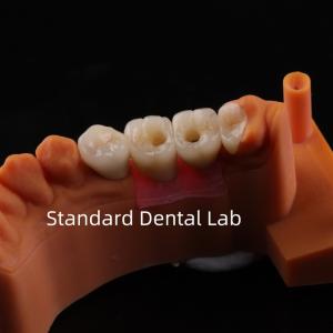 Wholesale Porcelain Zirconia Dental Implant Bridge Professional High Esthetics from china suppliers