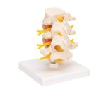 0.45kg Medical Anatomy Education 20x16x10cm Lumbar Spine Model