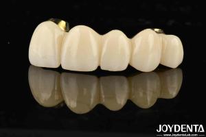 Wholesale Excellent Strength Ti-Bar Zirconia Hybrid Bridge For Natural Teeth And Gums Compatibility from china suppliers