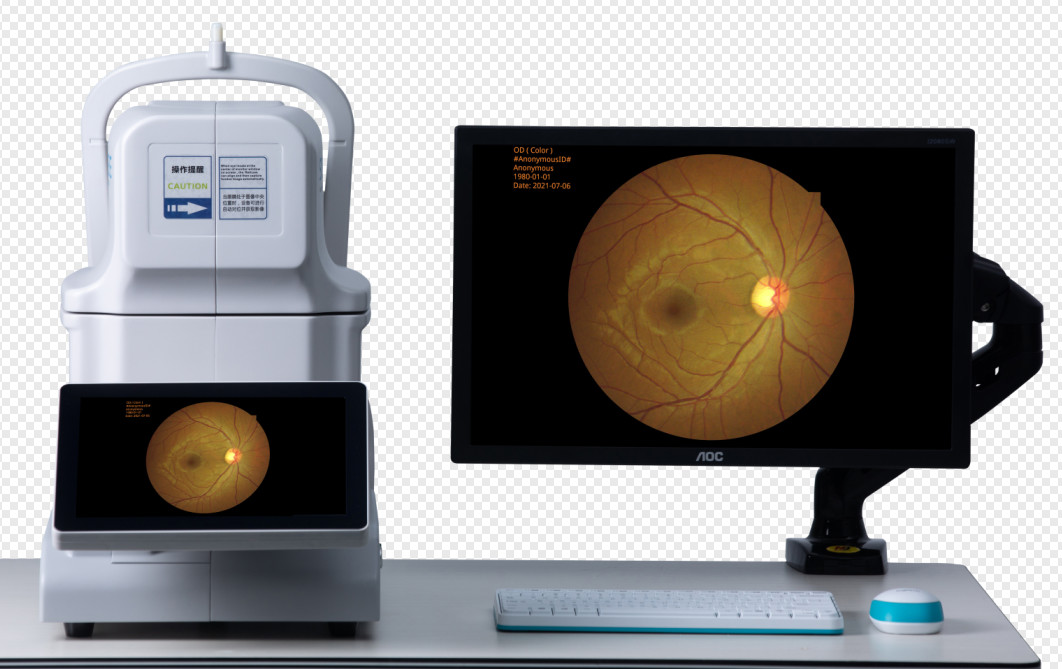 One Key Click Non Mydriatic Fundus Camera 3264×2488 Mini Picture Acquired Automatically
