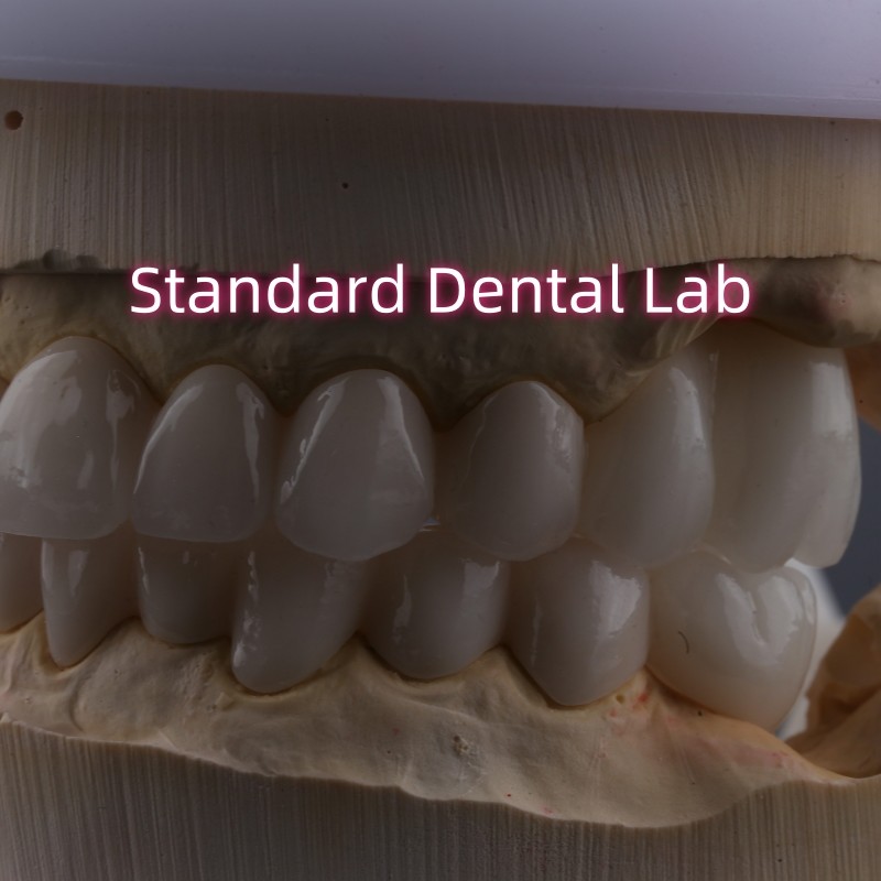 Dental Lab Full Arch Zirconia Porcelain Crowns PFZ Crown ISO FDA CE