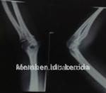Transparency Digital X Ray Film , Medical Imaging AGFA / Fuji X Ray Dry Film