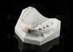 Non Removable Lingual Wire Retainer Invisible Direct Bonded Lingual Retainer