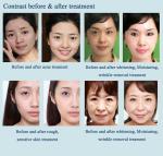 Skin Beauty Water Mesotherapy Equipment Vacuum Injection HIFU