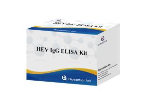 Wholesale HEV Human Igg Elisa Kit Diagnostic For IgG Antibody To Hepatitis E Virus from china suppliers