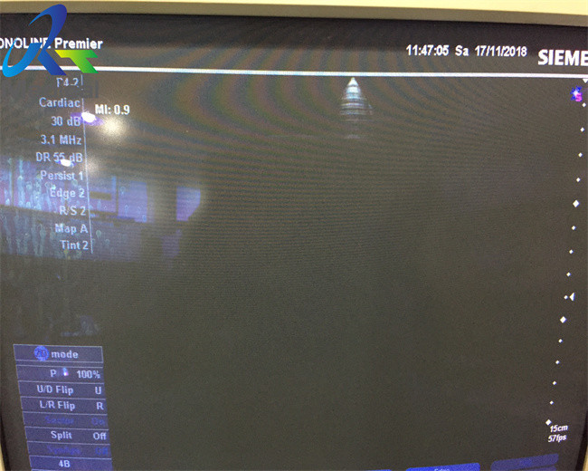 Siemens P4-2 Phased Array Probe Cardiac Transducer No Allergic Reaction Hospital Imaging System