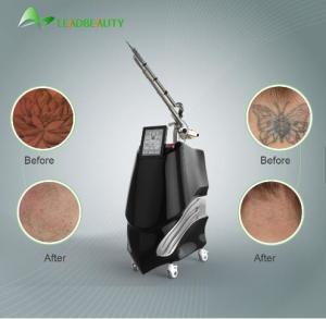 Wholesale Acne removal; Tattoo removal Q-switched 1064/532nm nd yag pico second laser for tattoo removal beauty equipment from china suppliers