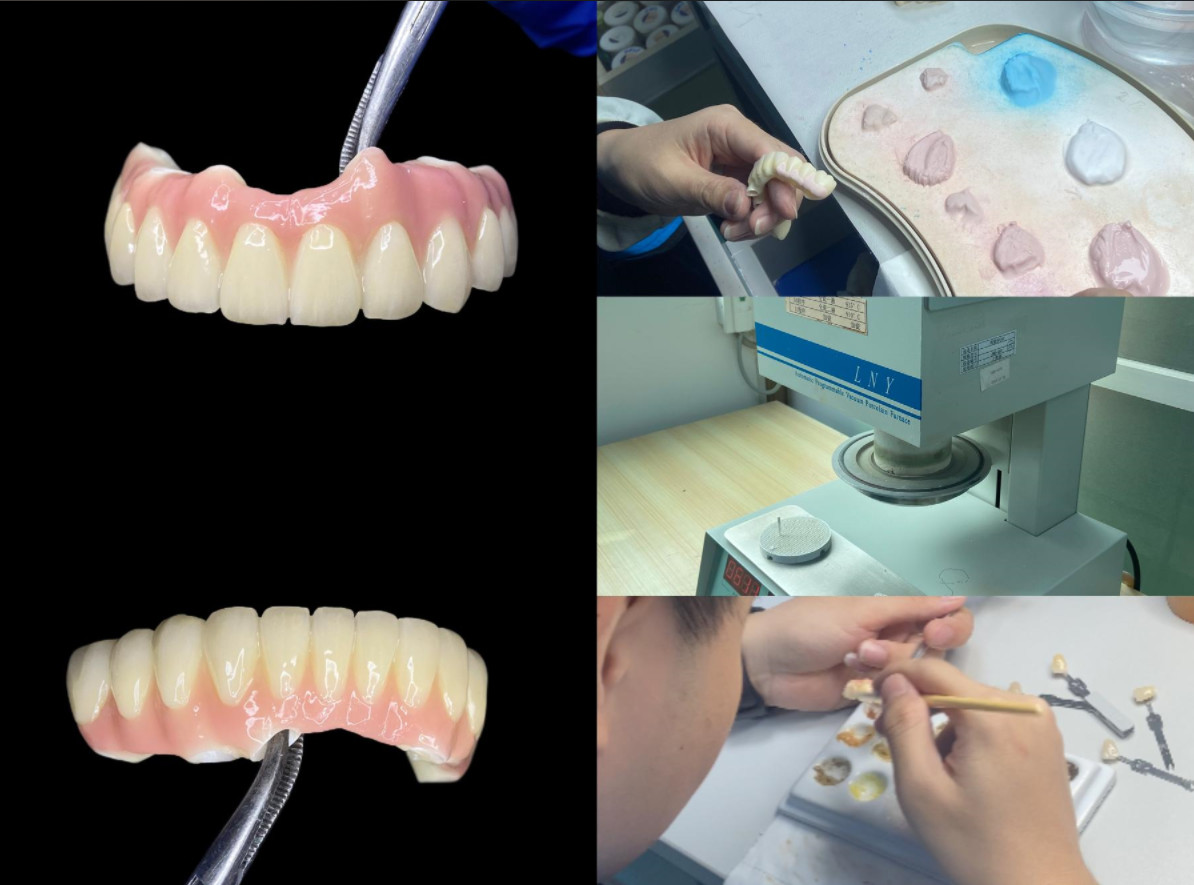 Replace Missing Teeth Dental Implant crown With Screw Titanium Base And Zirconia Crown