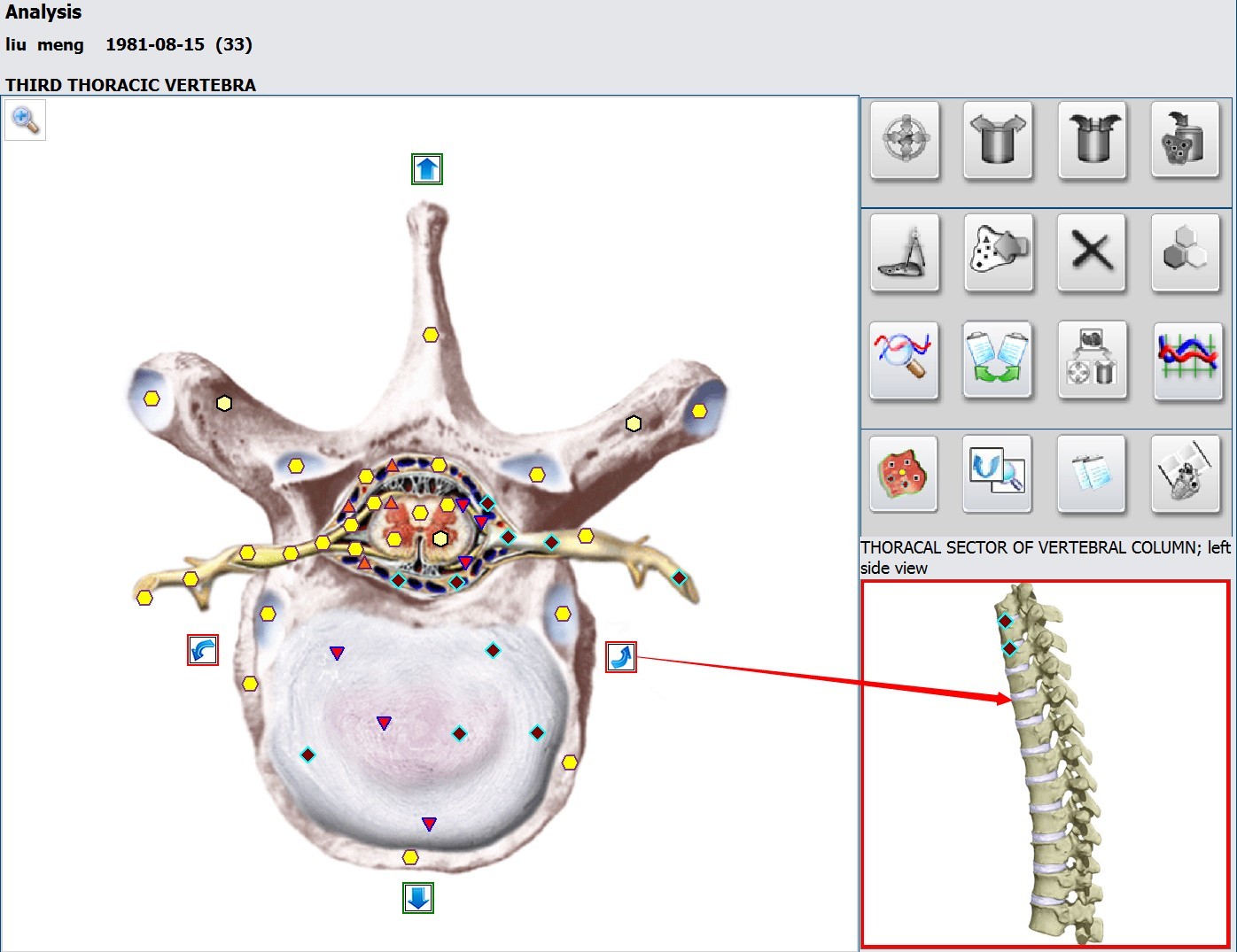 Metatron Diagnostic Machine Nls Biofeedback System Homeopathy Phytotherapy Lithotherapy