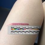 Self Adhesive Medical Paper Wound Measuring Tape For Nurse Patients