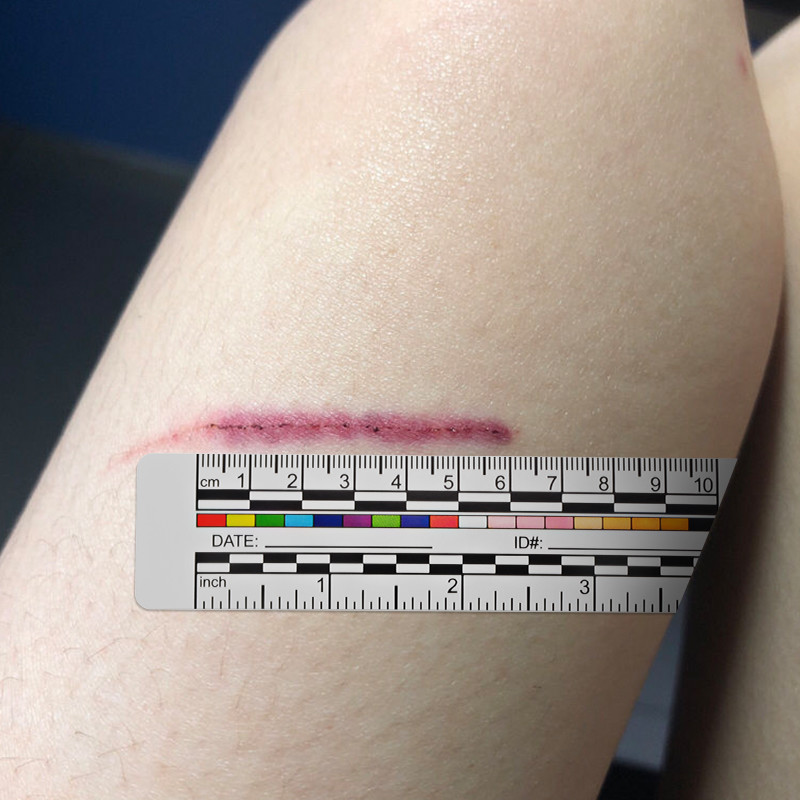 Self Adhesive Medical Paper Wound Measuring Tape For Nurse Patients