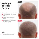 Pain Relief 808nm 650nm Cold Laser Therapy Device Red Light Therapy