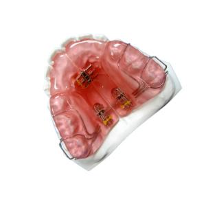 China High Hardness FDA Functional Appliance Orthodontic Rubber Retainer on sale
