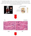 Muscle Message 635nm 660nm 850nm LED Red Light Therapy Beds For Chiropractic Use