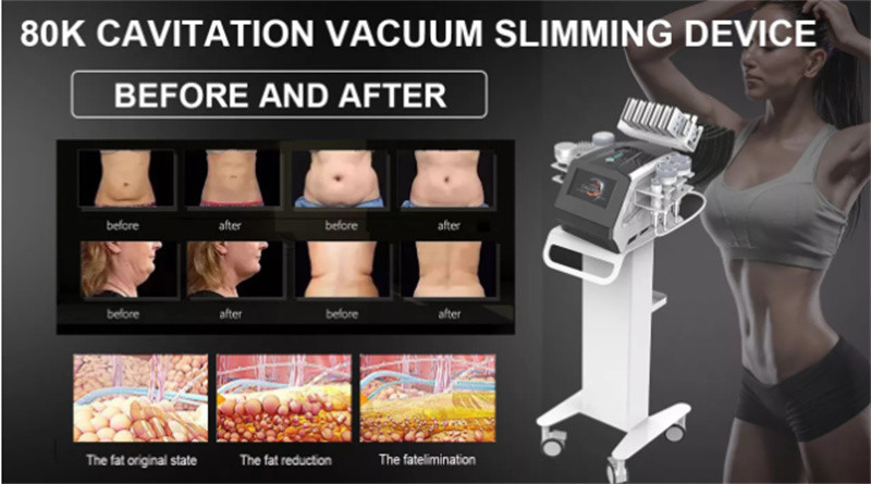 80k Rf Cavitation Vacuum Device Ultrasonic Skin Lifting Fat Removal Lipo Laser Pads Beauty