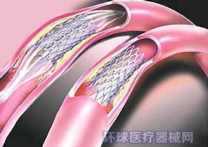 Wholesale NiTi Parts Medical Wire Forming , OEM Manufacturing Custom Metal Forming from china suppliers