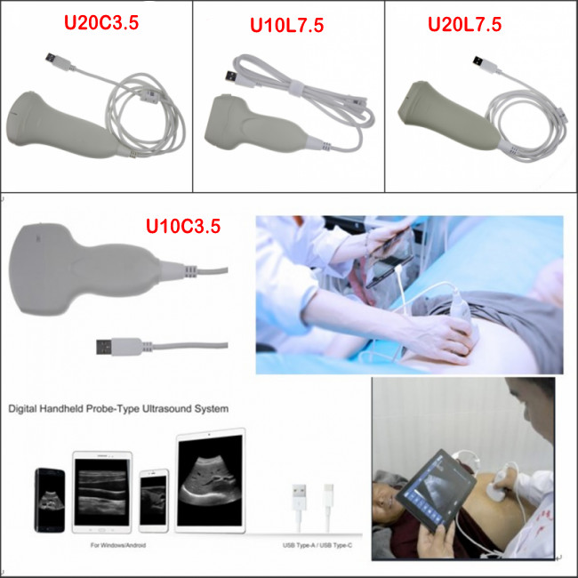 Medical Factory Price Digital Electric Linear Ultrasound Transducer Probe For Android Smart Phone