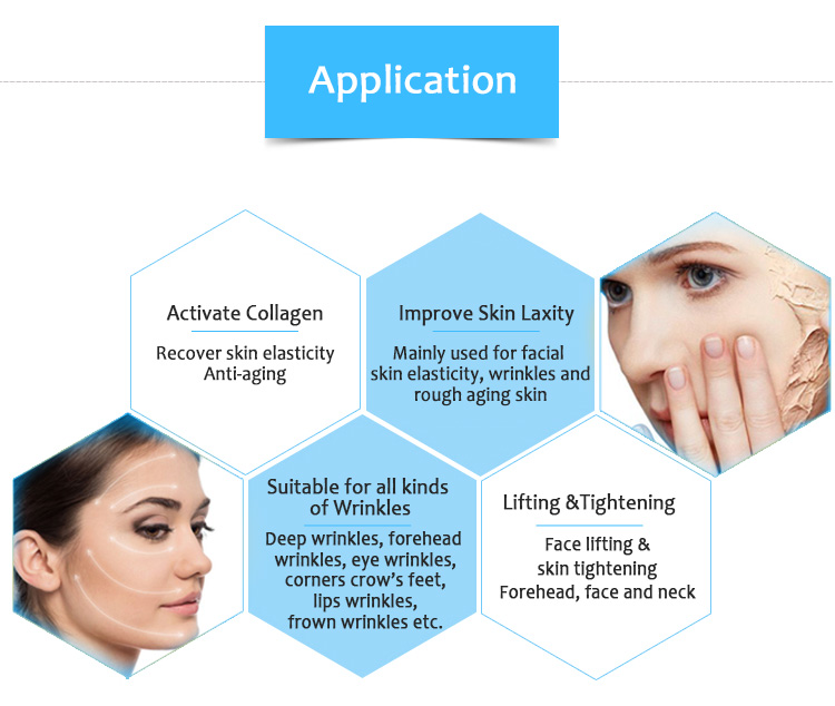 best skin lifting top quality hifu high intensiy foused anti aging 3d face lifting Medical ultrasound machine